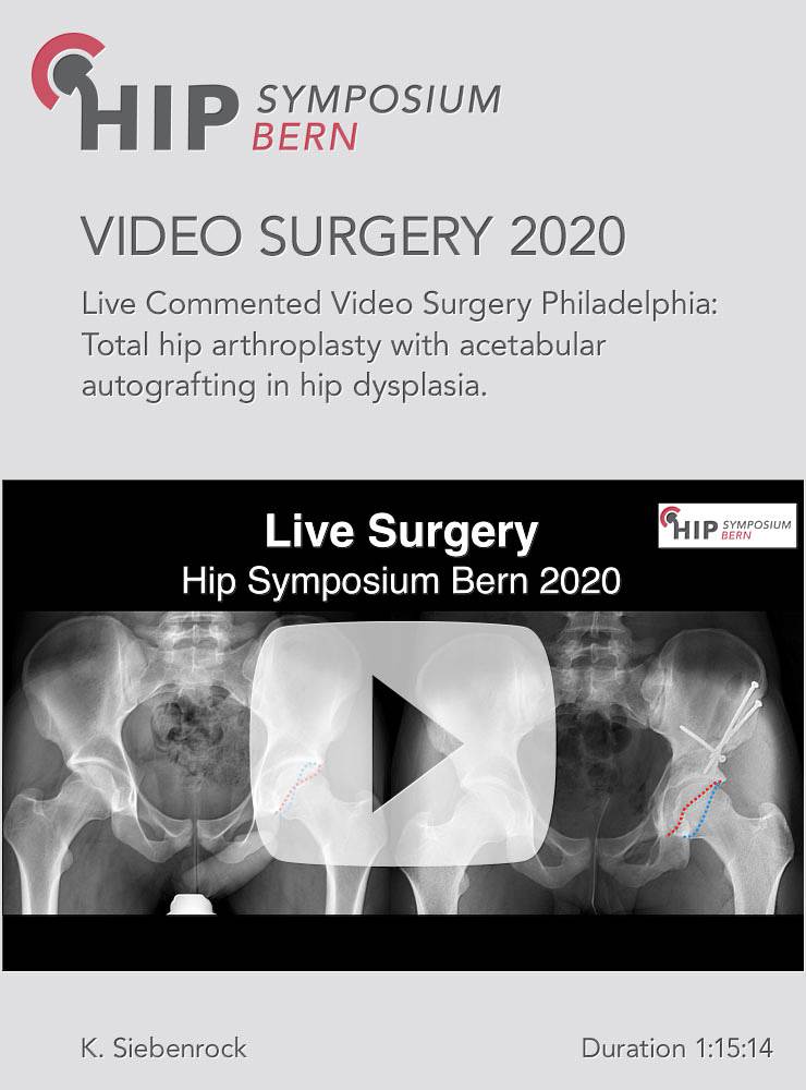 Live commented video Surgery from Rothman Institute, Philadelphia / J. Parvizi