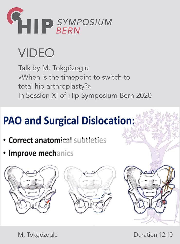 When is the timepoint to switch to total hip arthroplasty? / M. Tokgözoglu