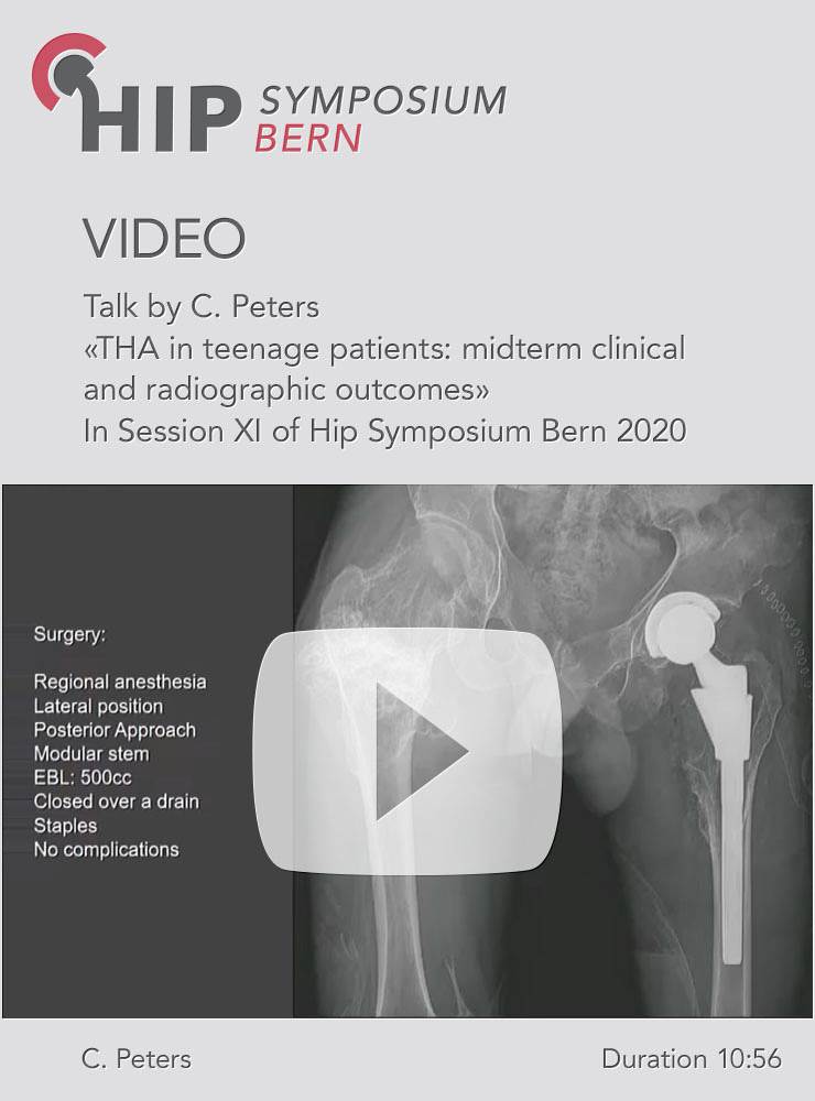 THA in teenage patients: midterm clinical and radiographic outcomes / C. Peters