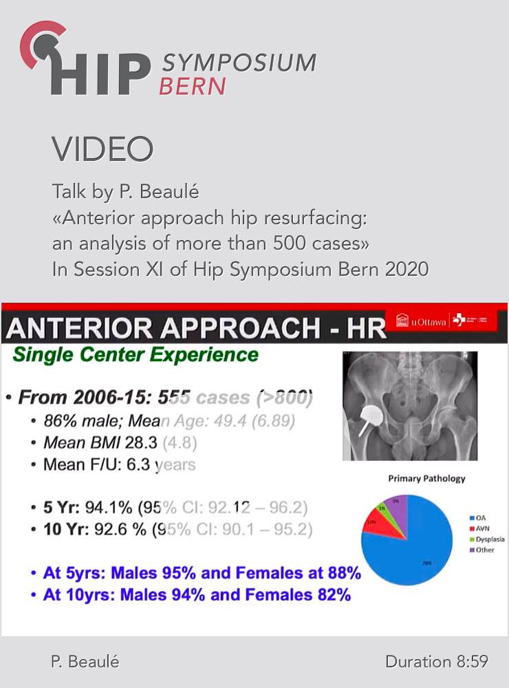 Anterior approach hip resurfacing: an analysis of more than 500 cases / P. Beaulé