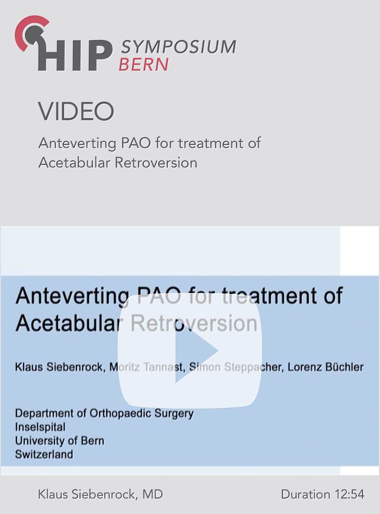 Anteverting PAO for treatment of acetabular retroversion Retroversion K A Siebenrock Bern