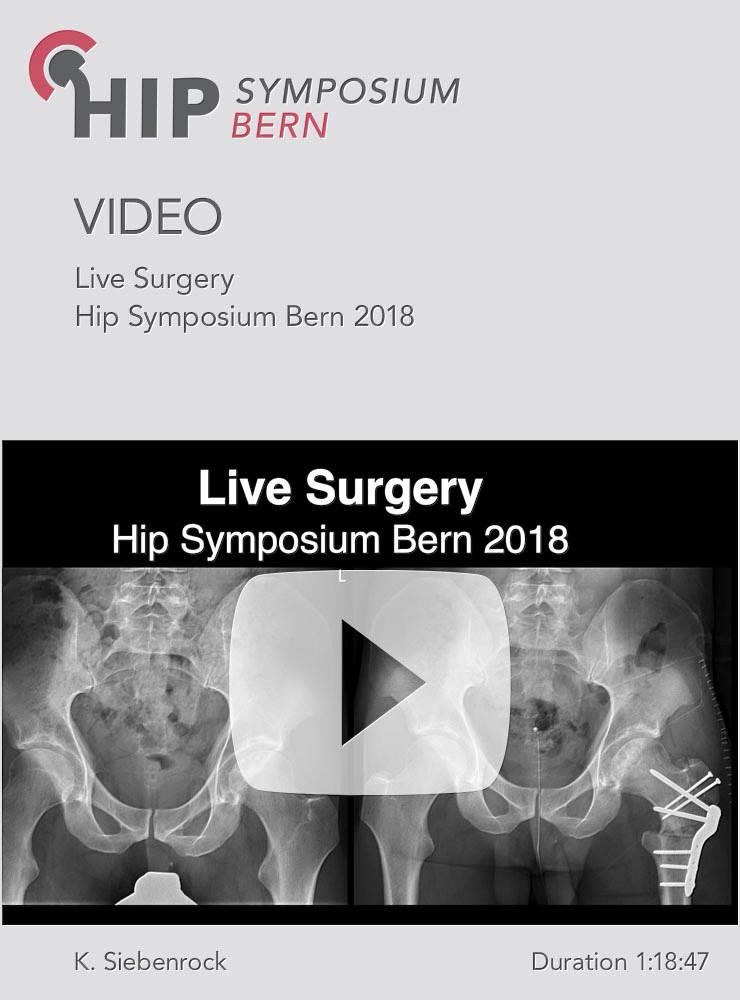 Live Surgery / Hip Symposium 2018