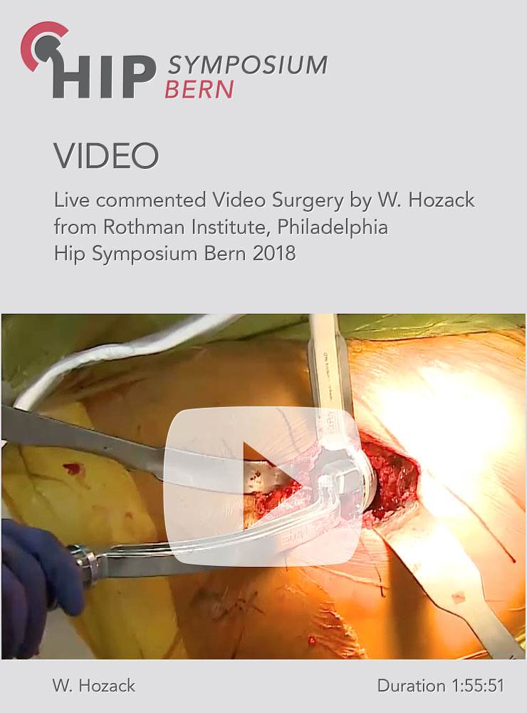 Live commented video Surgery 2018 / William Hozack