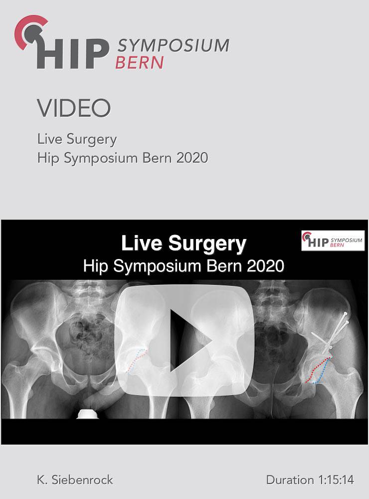 Live Surgery Hip Symposium 2020 / K. Siebenrock
