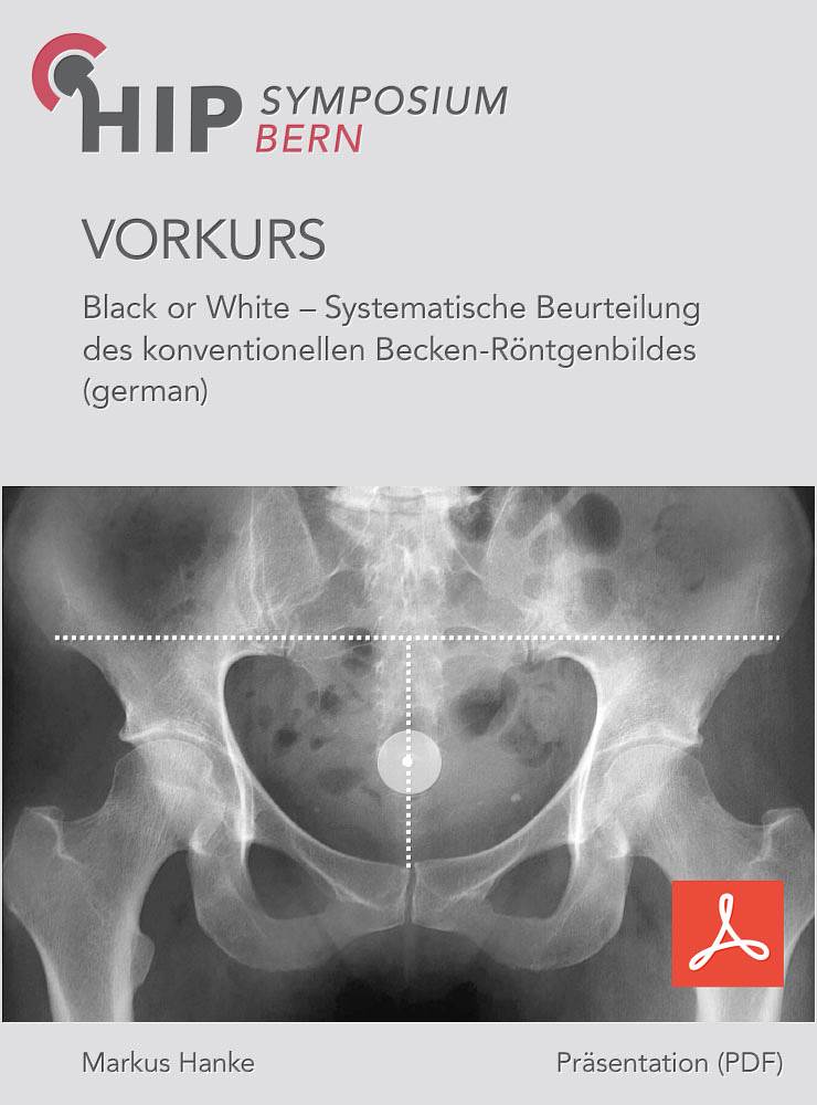 Vorkurs 2018 - Hanke - Black Or White - Systematische Beurteilung des konventionellen Becken-Röntgenbildes