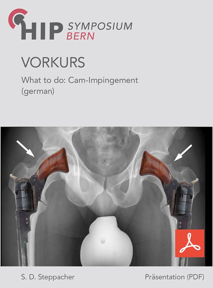 Vorkurs 2018 - Steppacher - What to do: Cam-Impingement