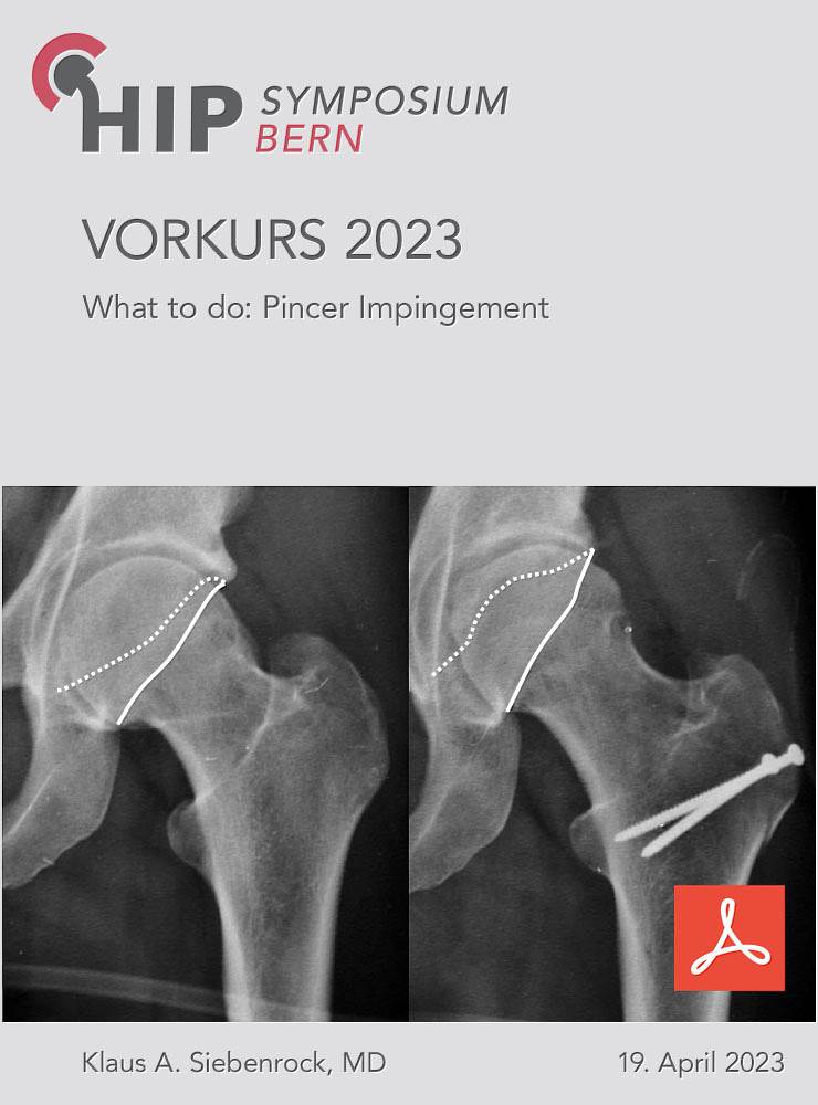 Vorkurs 2023 - Siebenrock - Pincer Impingement