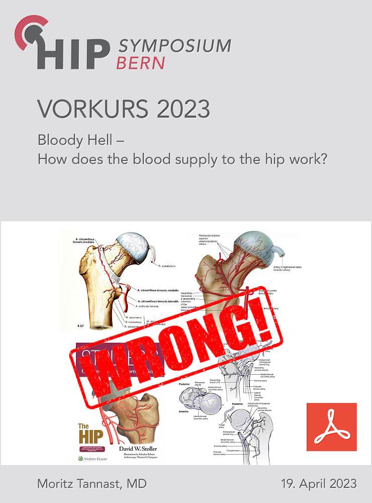 Vorkurs 2023 - Tannast - Bloody Hell – How does the blood supply to the hip work?