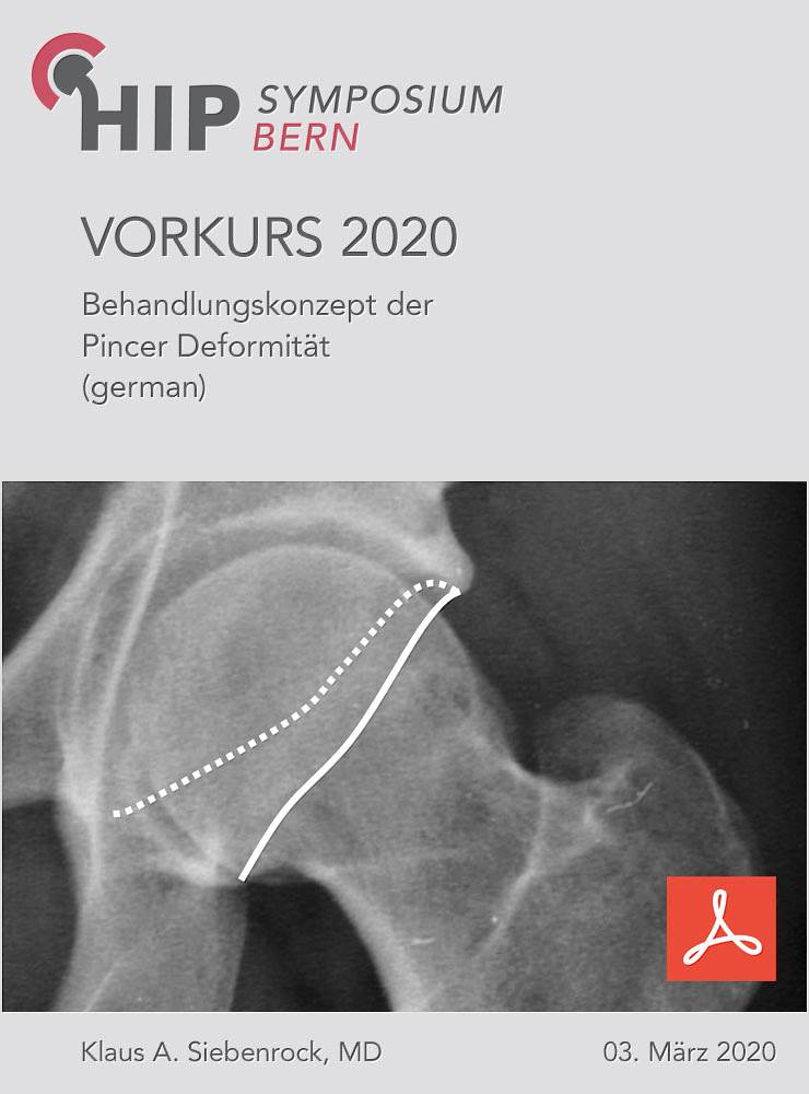 Vorkurs 2020 - Siebenrock - Behandlungskonzept der Pincer Deformität